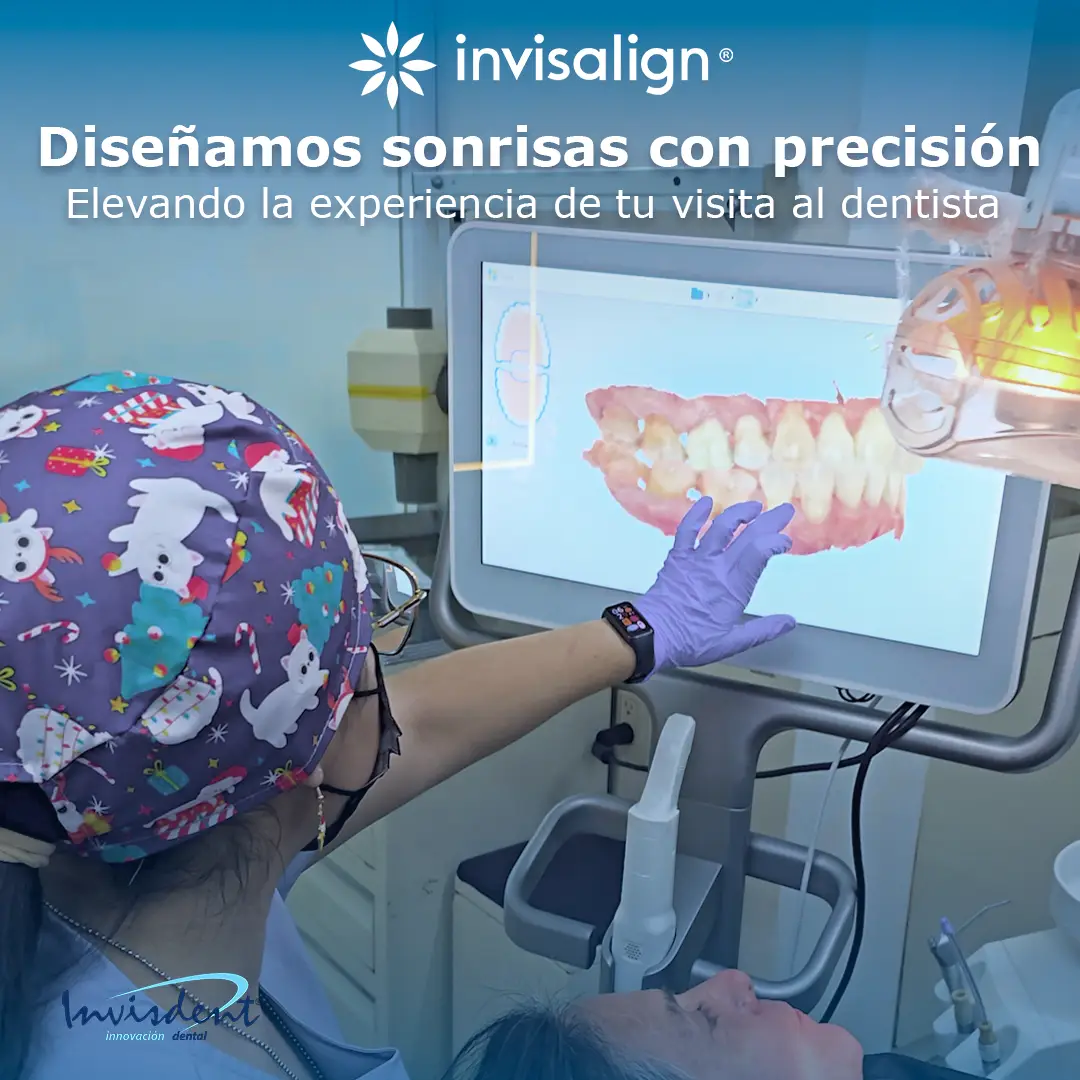 Escaneo digital para alineadores Invisalign