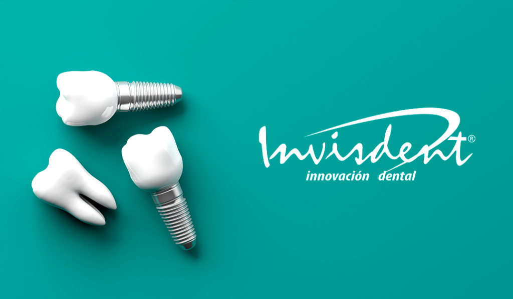 Mitos y verdades de los implantes dentales